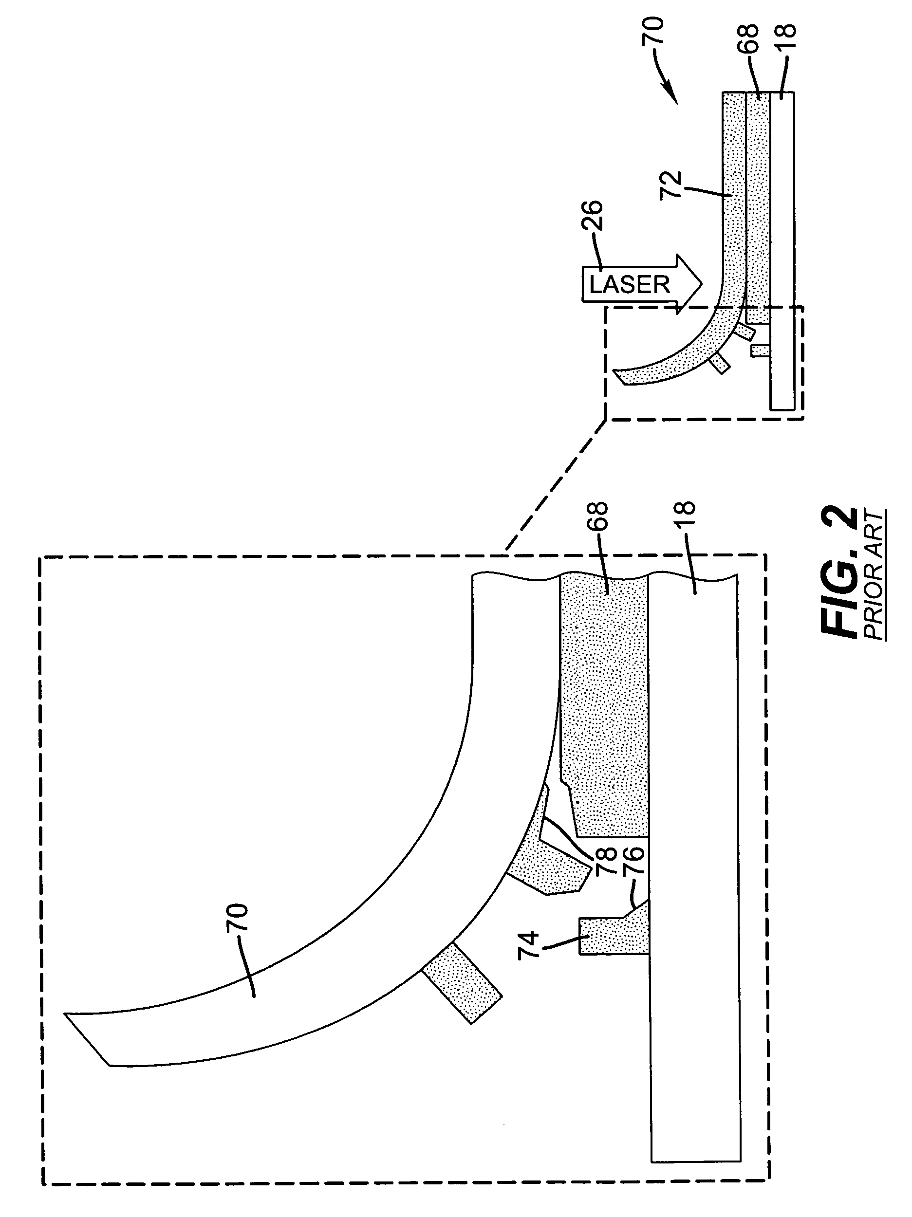 Laser resist transfer for microfabrication of electronic devices