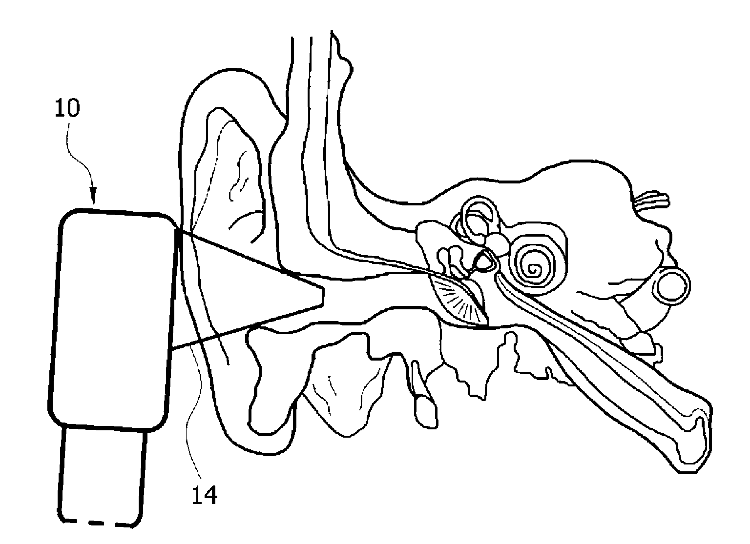 Probe for Diagnosing Otitis Media Using Terahertz Waves and Otitis Media Diagnosis System and Method