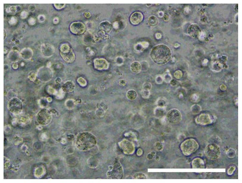 Method for culturing organoid by using elastin hydrogel