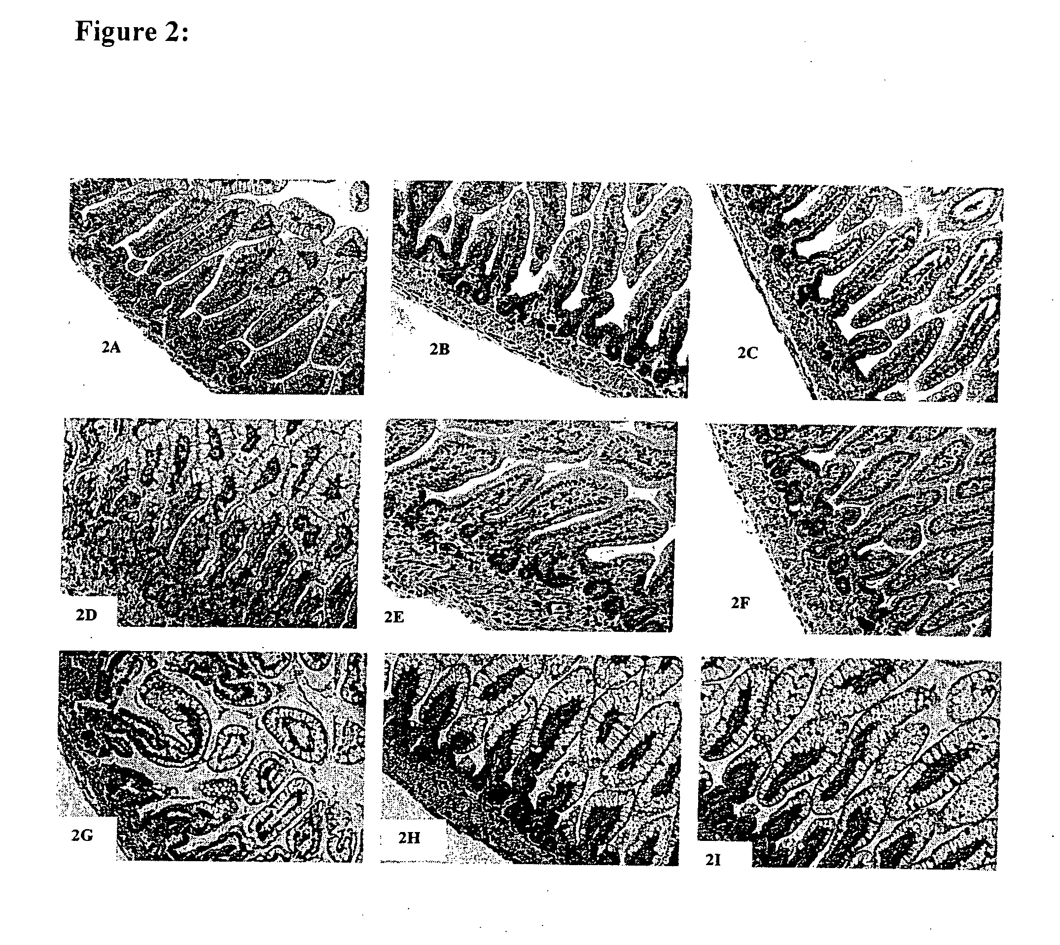 Method for treating or preventing systemic inflammation in formula-fed infants