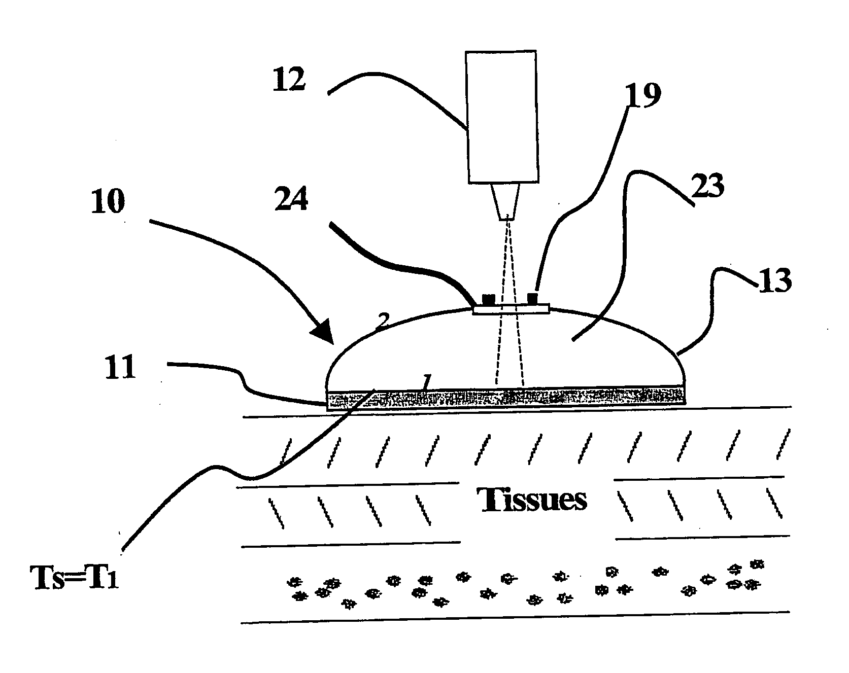 Temperature measurement device