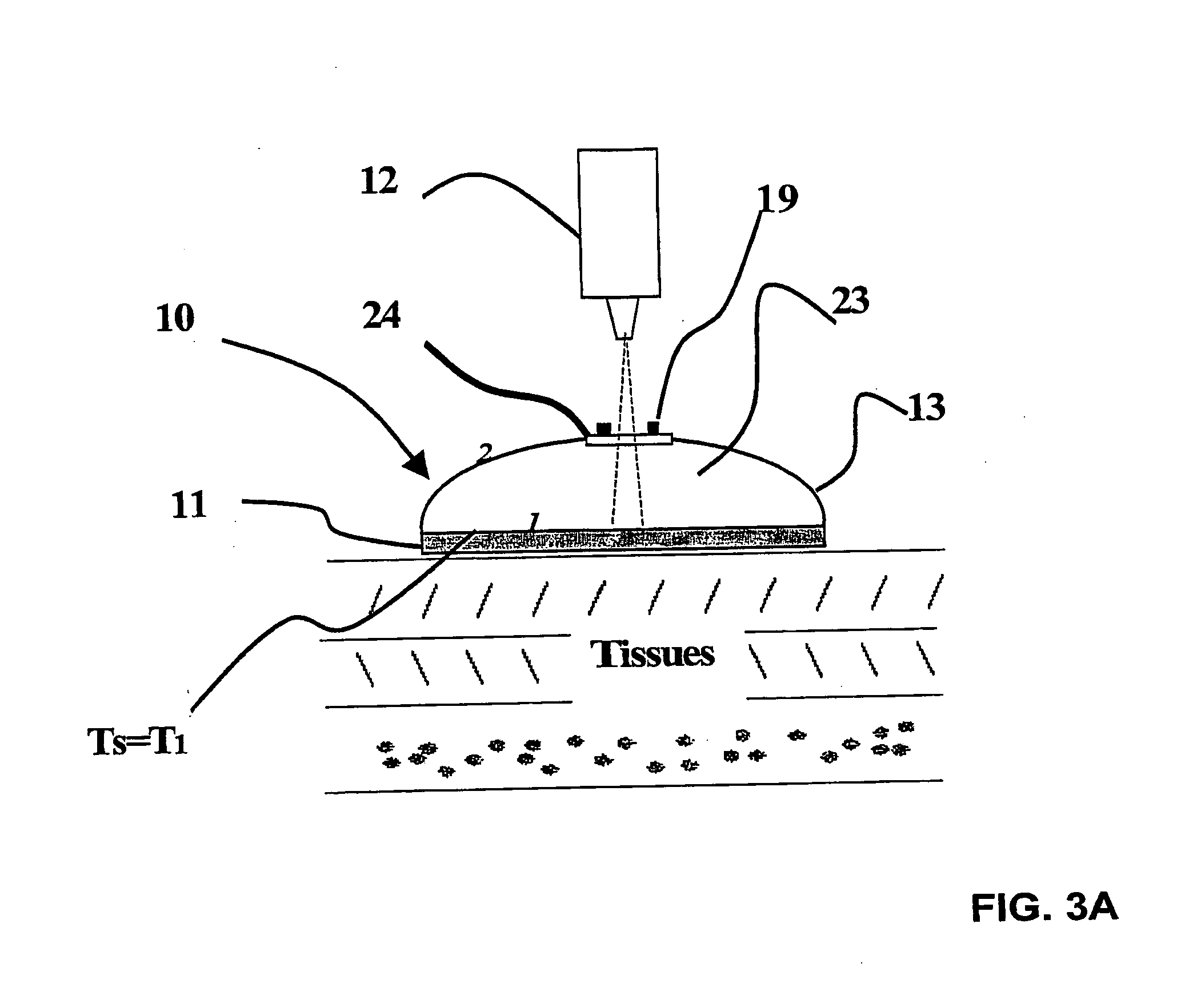 Temperature measurement device