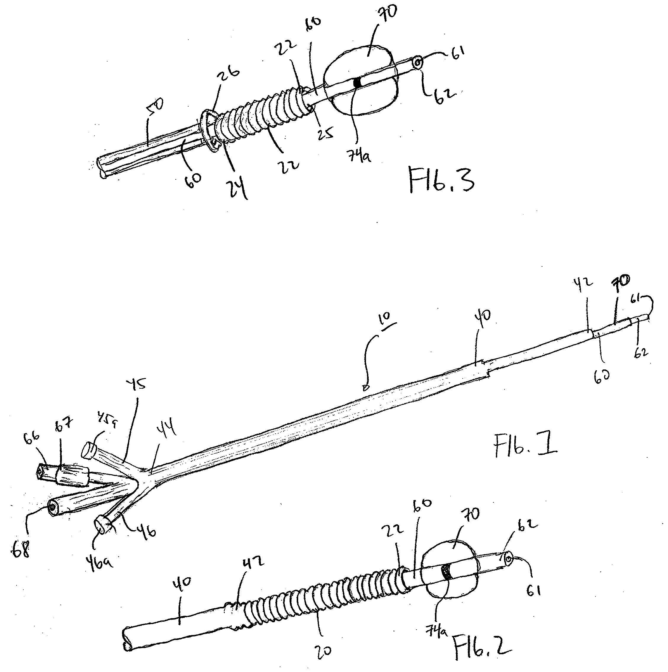 Prostatic stent placement device