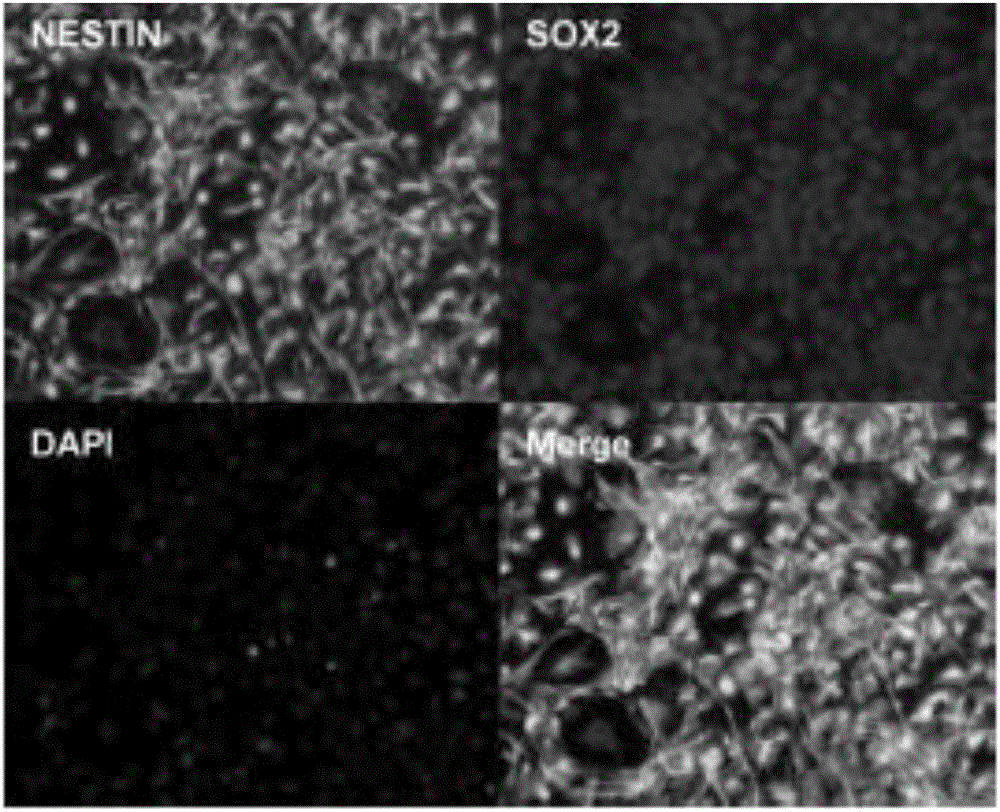 Kit and method for in-vitro directionally differentiating human-derived iPS stem cells into nerve cells