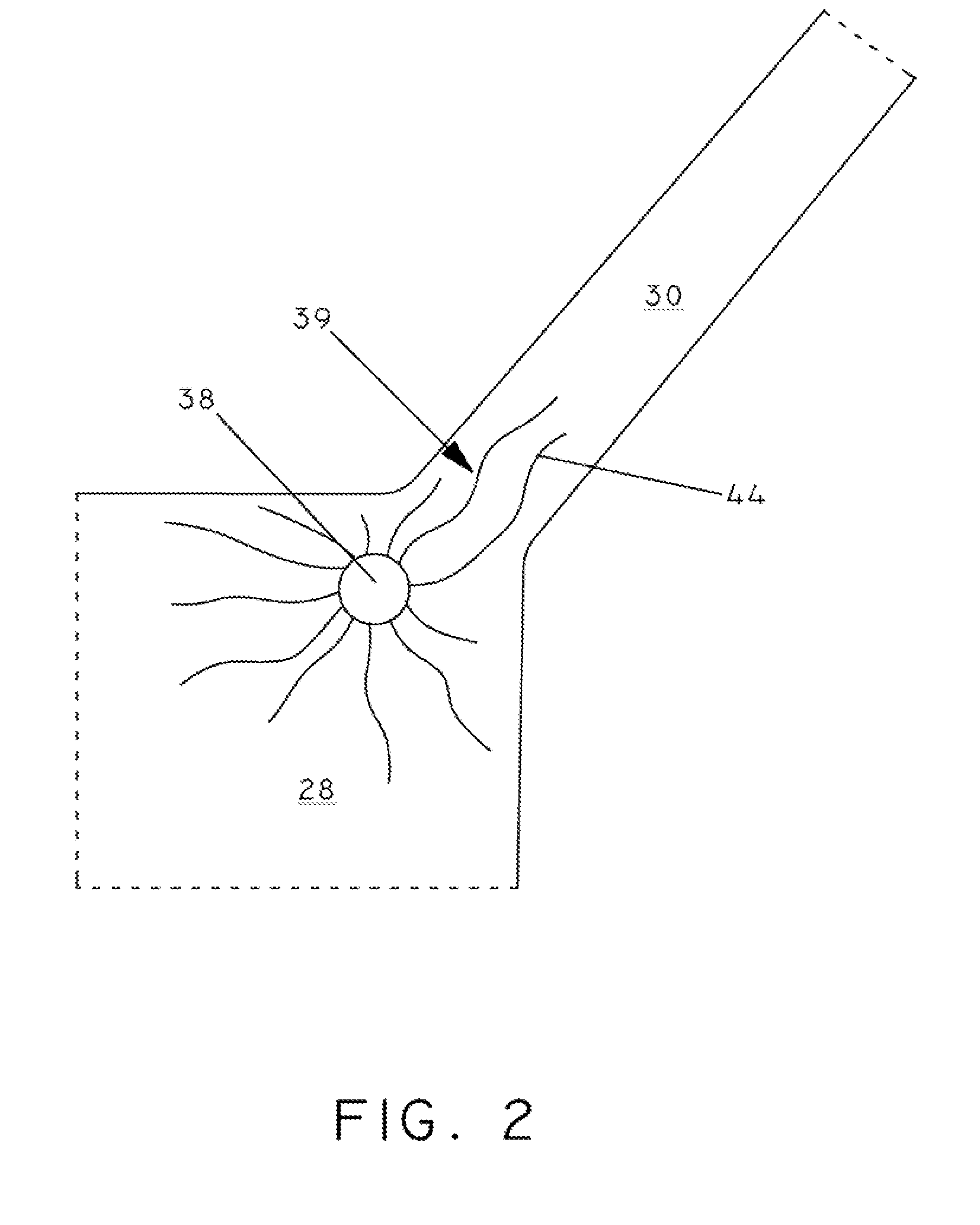 High Frequency Stimulation for Treatment of Atrial Fibrillation