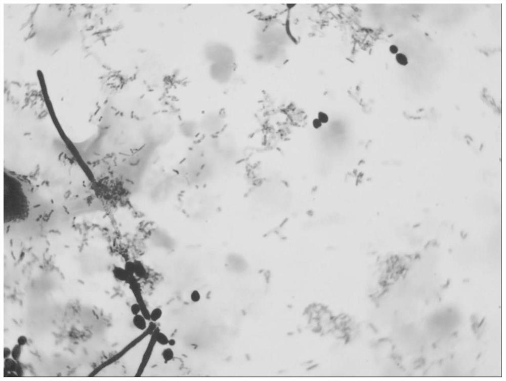 Rotating box object detection method for female vaginal pathogens based on r3det