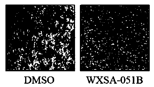 Pyridine compound and its preparation method and anti-gastric cancer application