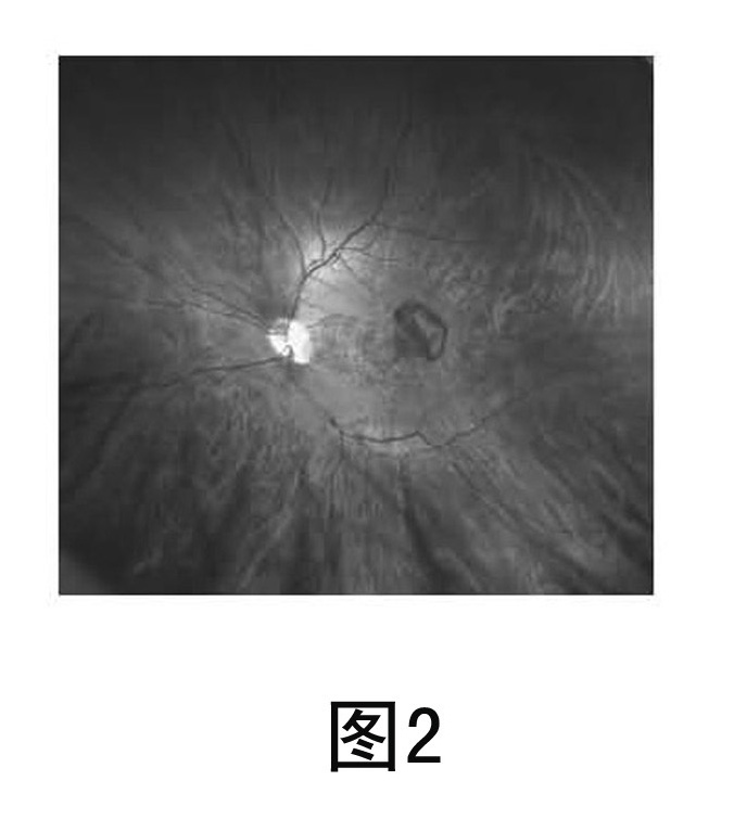 Panretinal optical function imaging system