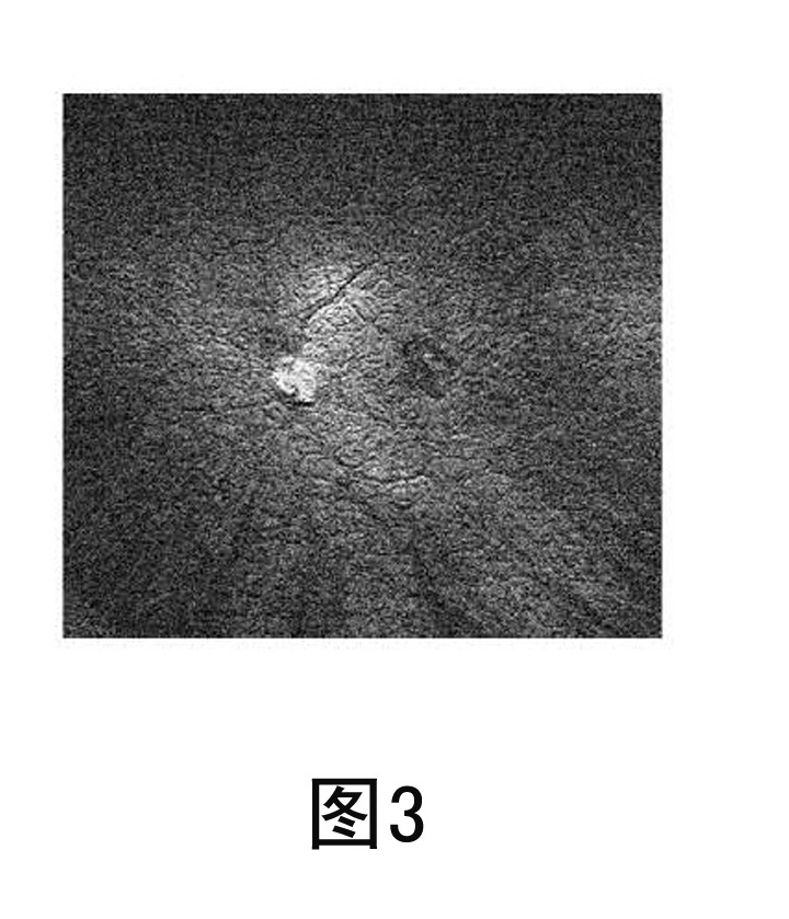 Panretinal optical function imaging system