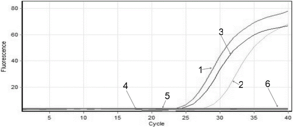 Toxoplasma gondii fluorogenic quantitative PCR (polymerase chain reaction) specific primer, kit and detecting method of toxoplasma gondii fluorogenic quantitative PCR specific primer