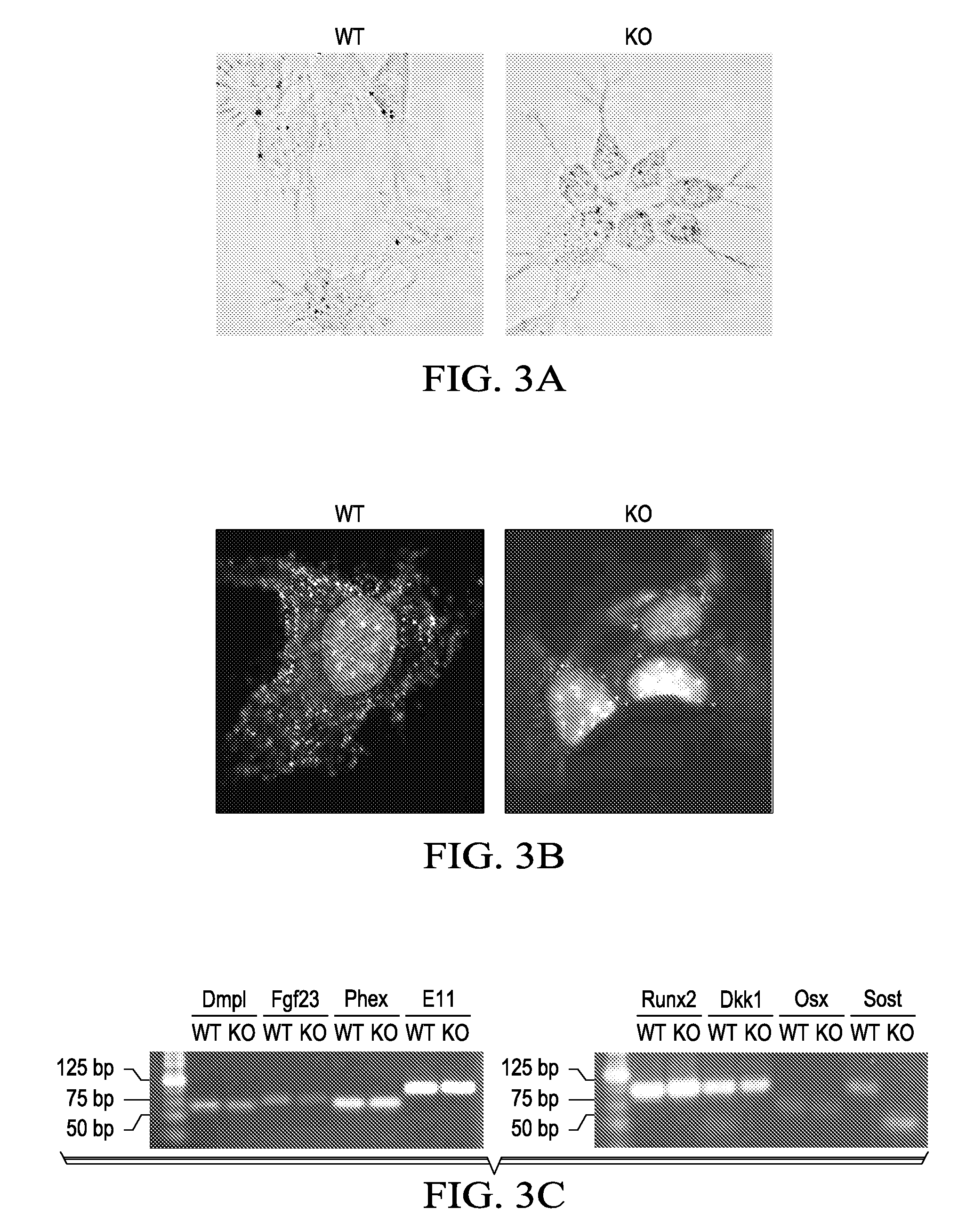 Prostacyclin compositions for regulation of fracture repair and bone formation