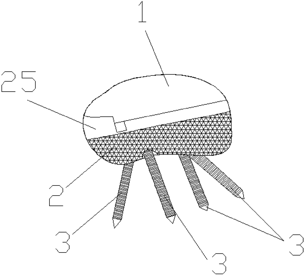 Talus prosthesis