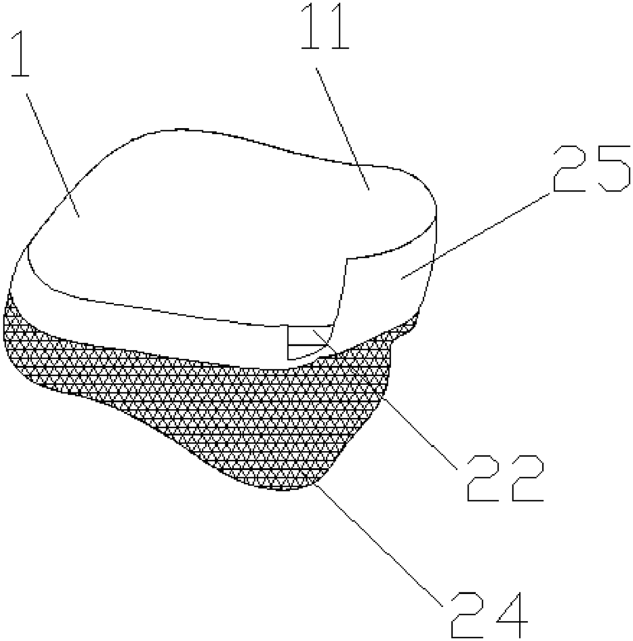 Talus prosthesis