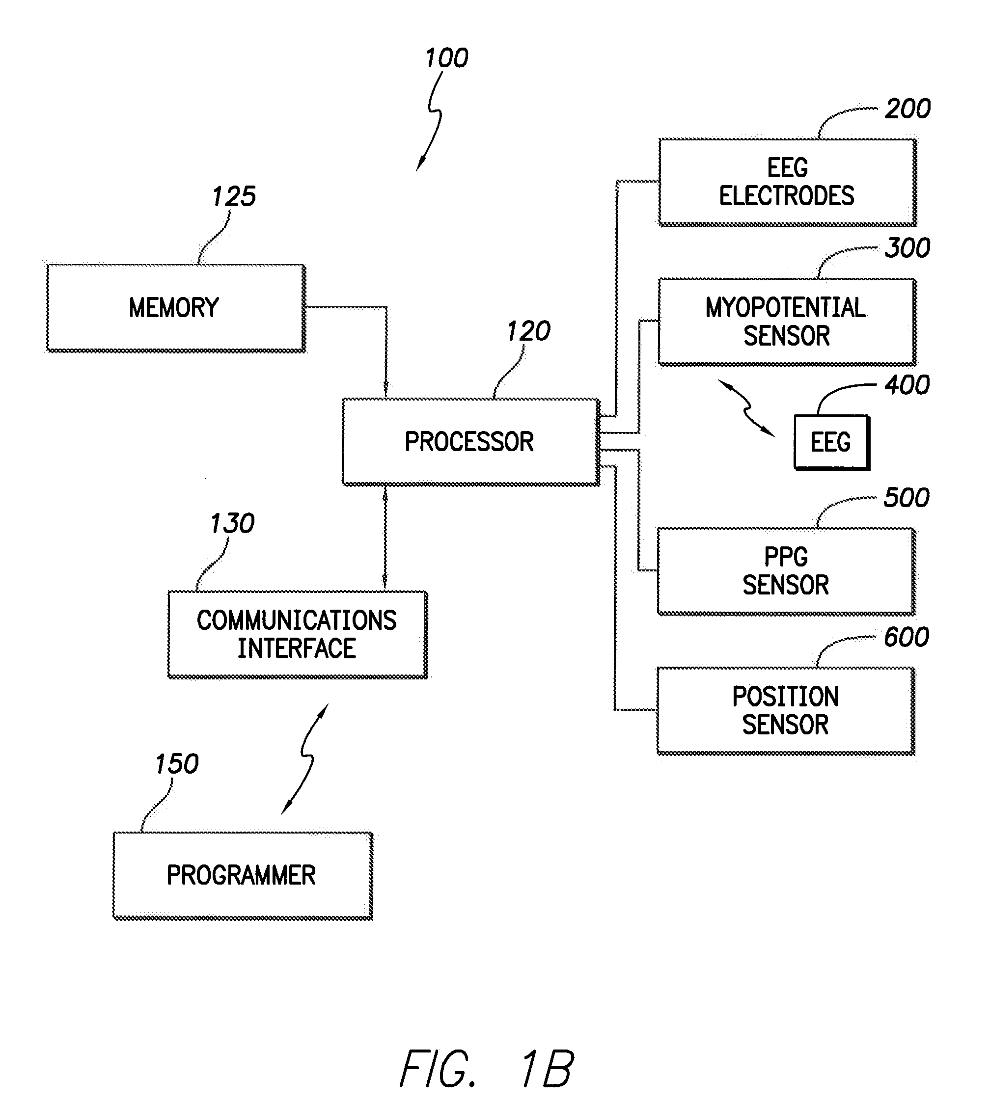 Multifaceted implantable syncope monitor - mism