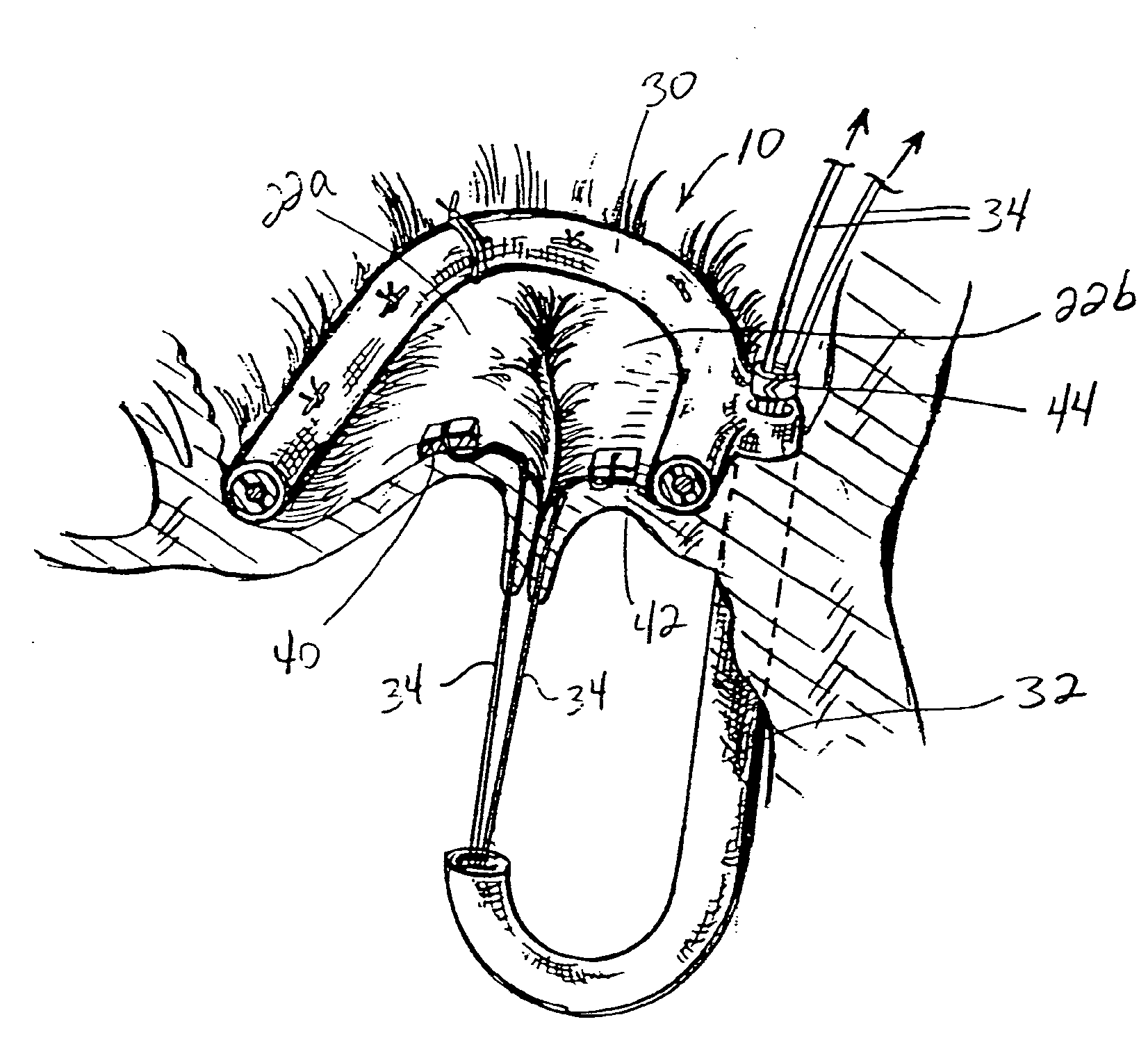 Heart valve repair apparatus and methods