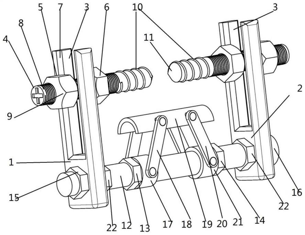 A kind of mandibular fracture external fixation bracket and fixation method thereof