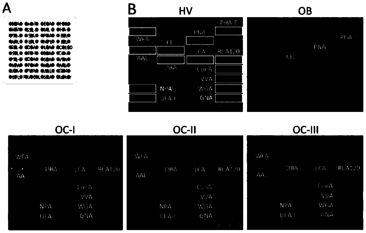 Use of a combination of specific lectins in the preparation of a test vector for identifying epithelial ovarian cancer and a kit