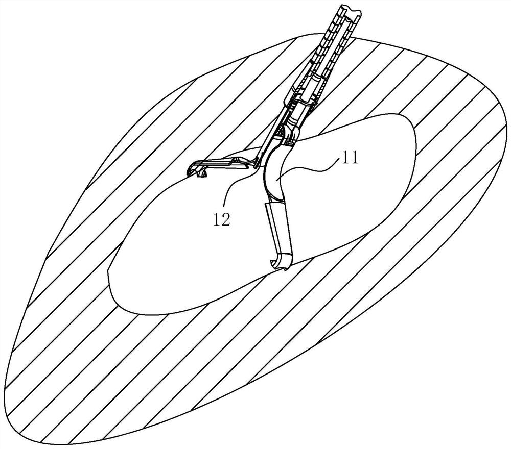 Tissue clamping device for endoscope