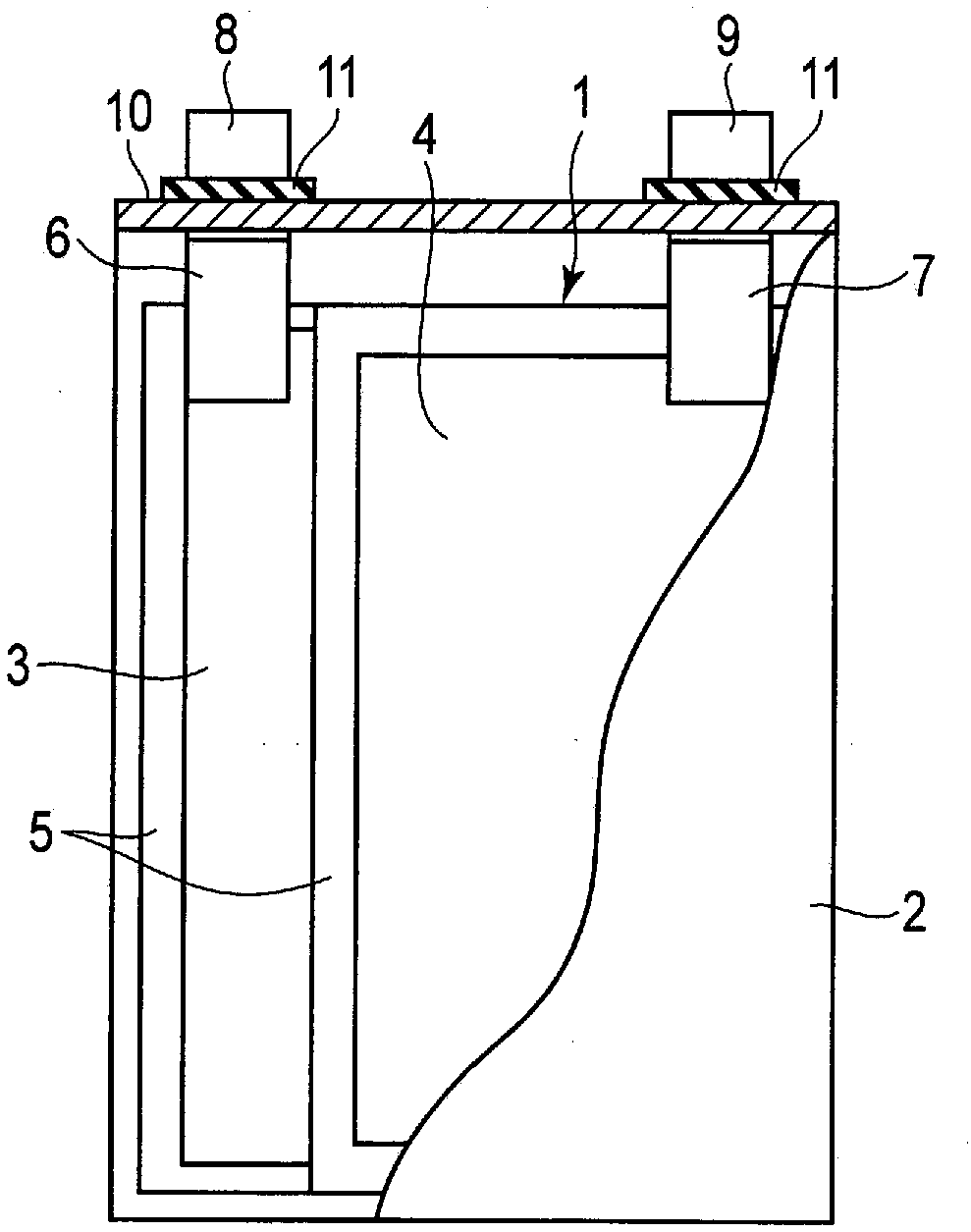 Secondary battery, battery pack, and vehicle