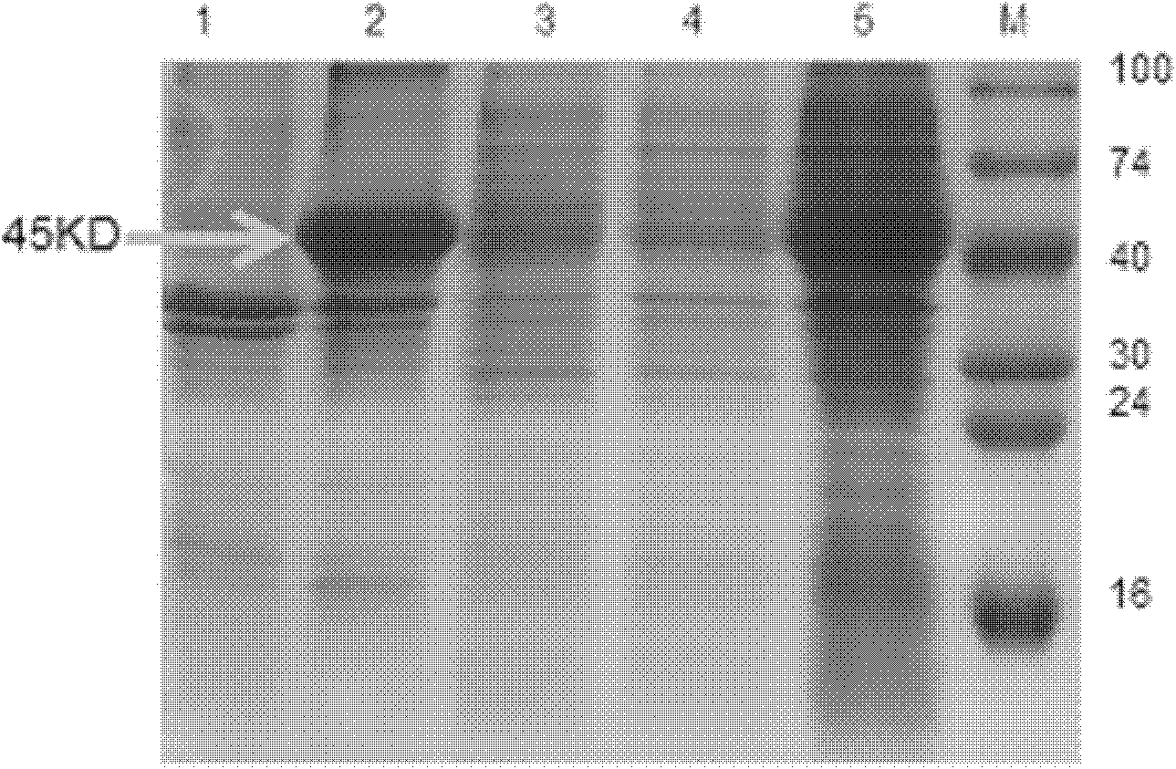 Monoclonal antibody of avian reticuloendotheliosis virus envelope protein and preparation method thereof