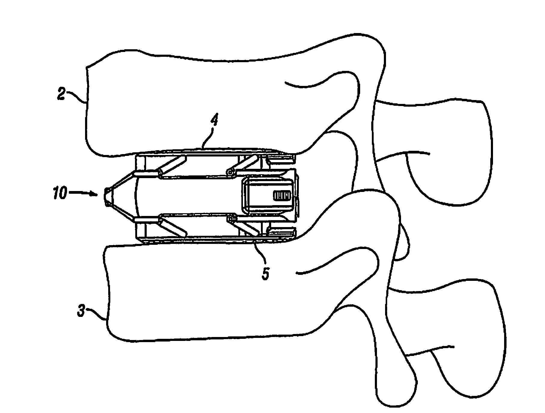 Expandable Fusion Device and Method of Installation Thereof