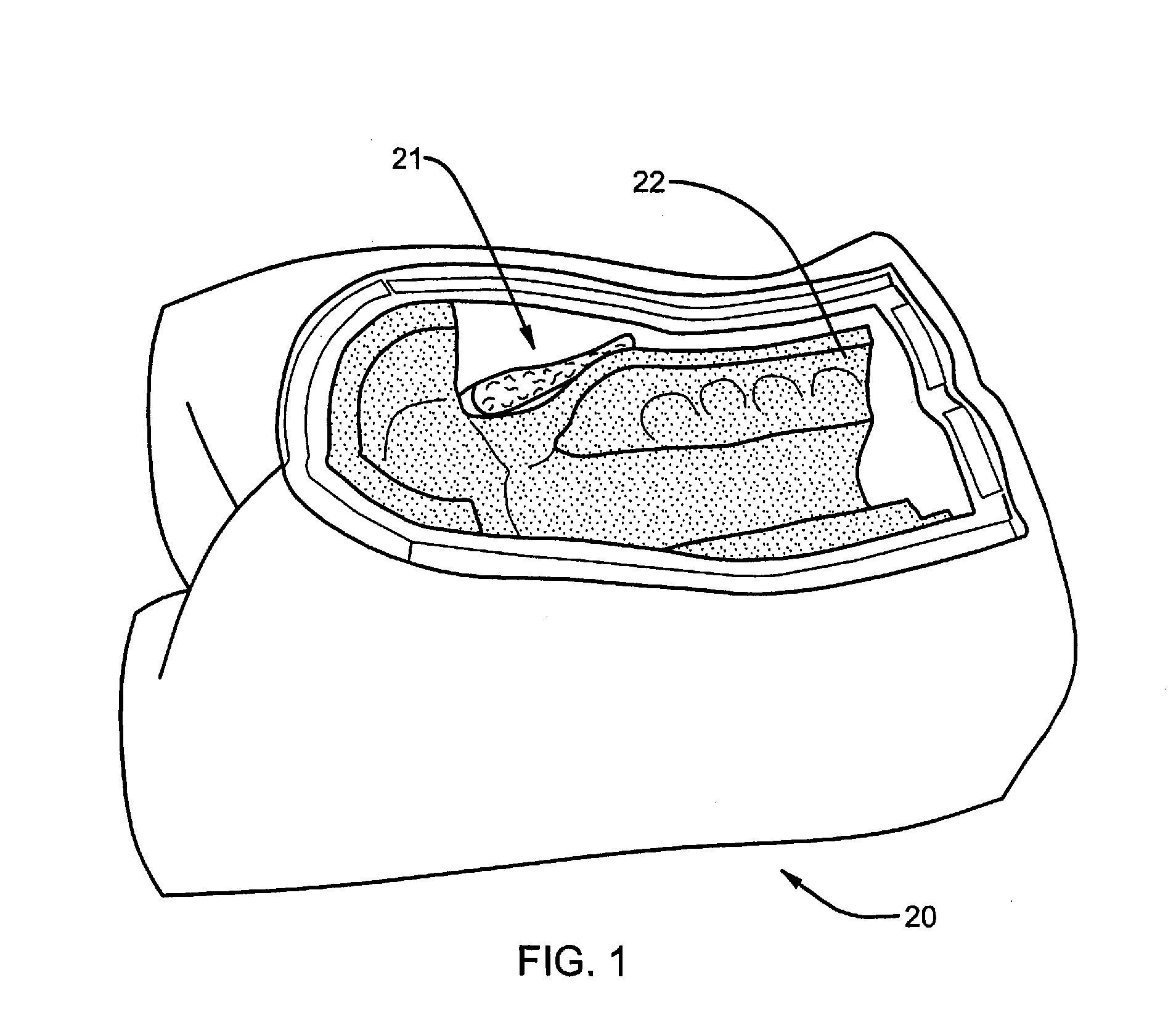 Surgical training model and method for use in facilitating training of a surgical procedure