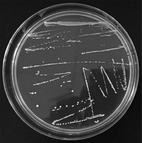 Lactobacillus rhamnosus and application thereof