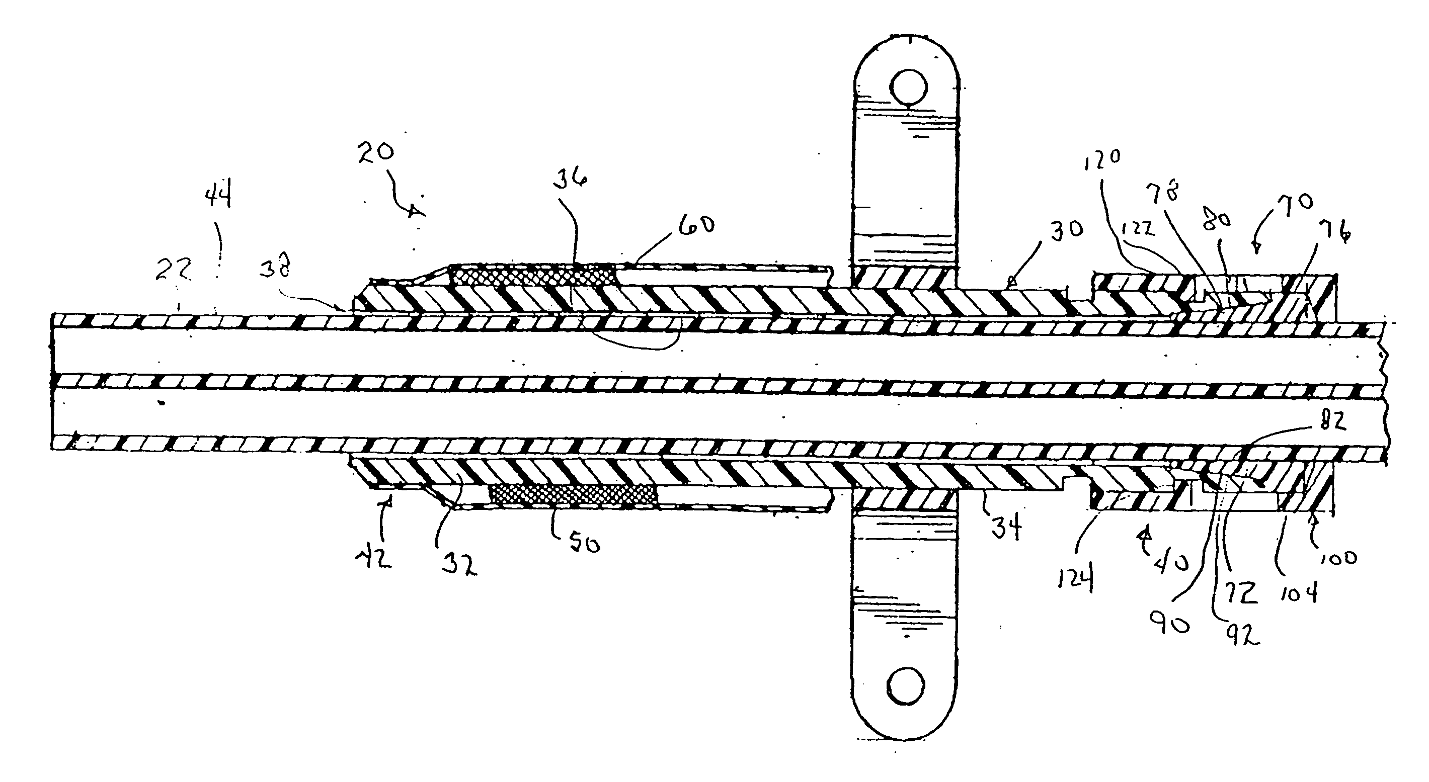 Apparatus and method for facilitating the replacement of an implanted catheter