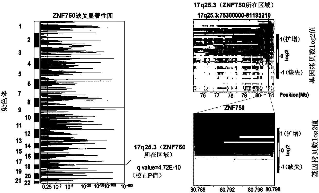 Application of ZNF750 in screening targeted medicine for treating esophageal squamous cell carcinoma