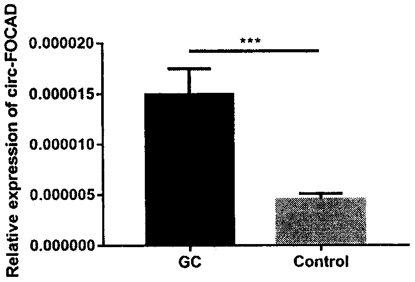 Application of circular RNA as diagnostic biomarker and therapeutic target for gastric cancer and colorectal cancer