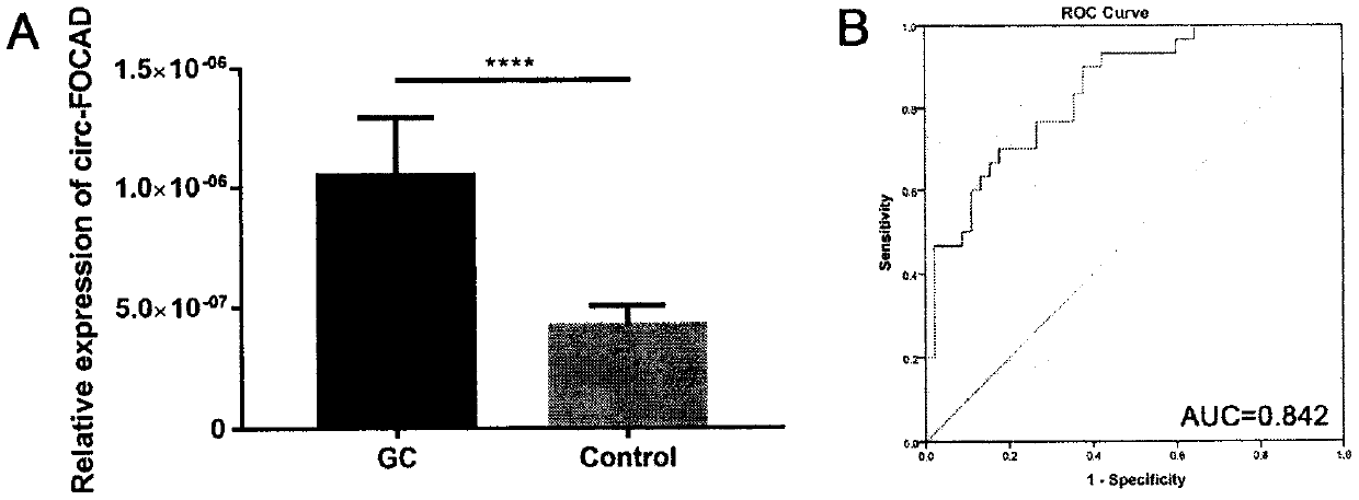 Application of circular RNA as diagnostic biomarker and therapeutic target for gastric cancer and colorectal cancer