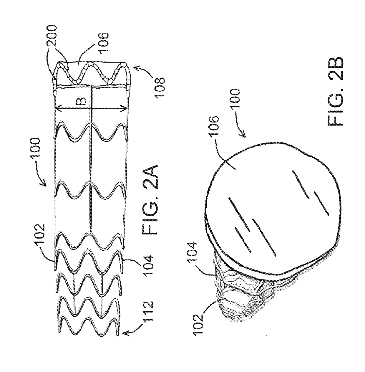 Devices, systems, and methods to precondition, arterialize, and/or occlude a mammalian luminal organ