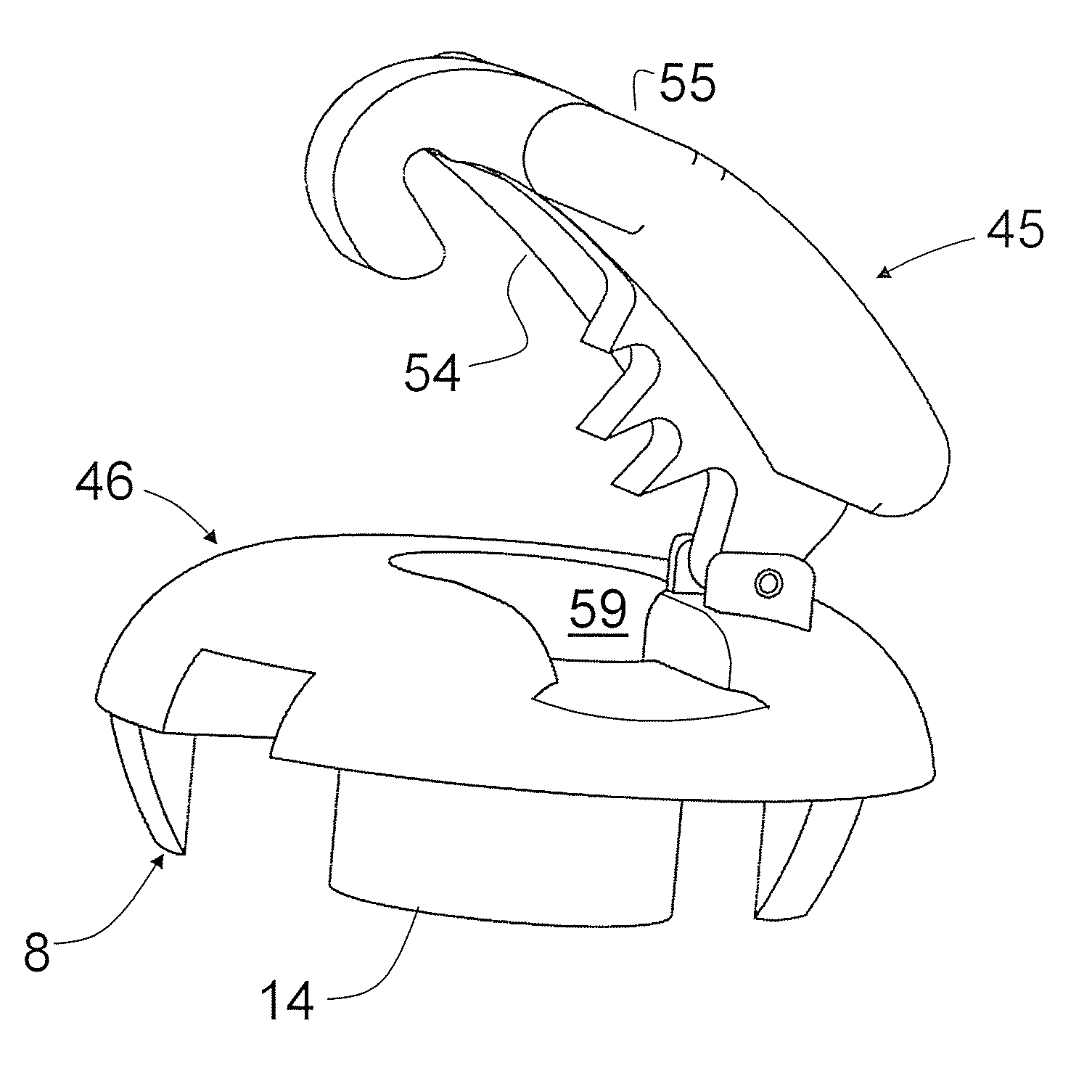 Soft tissue fixation device