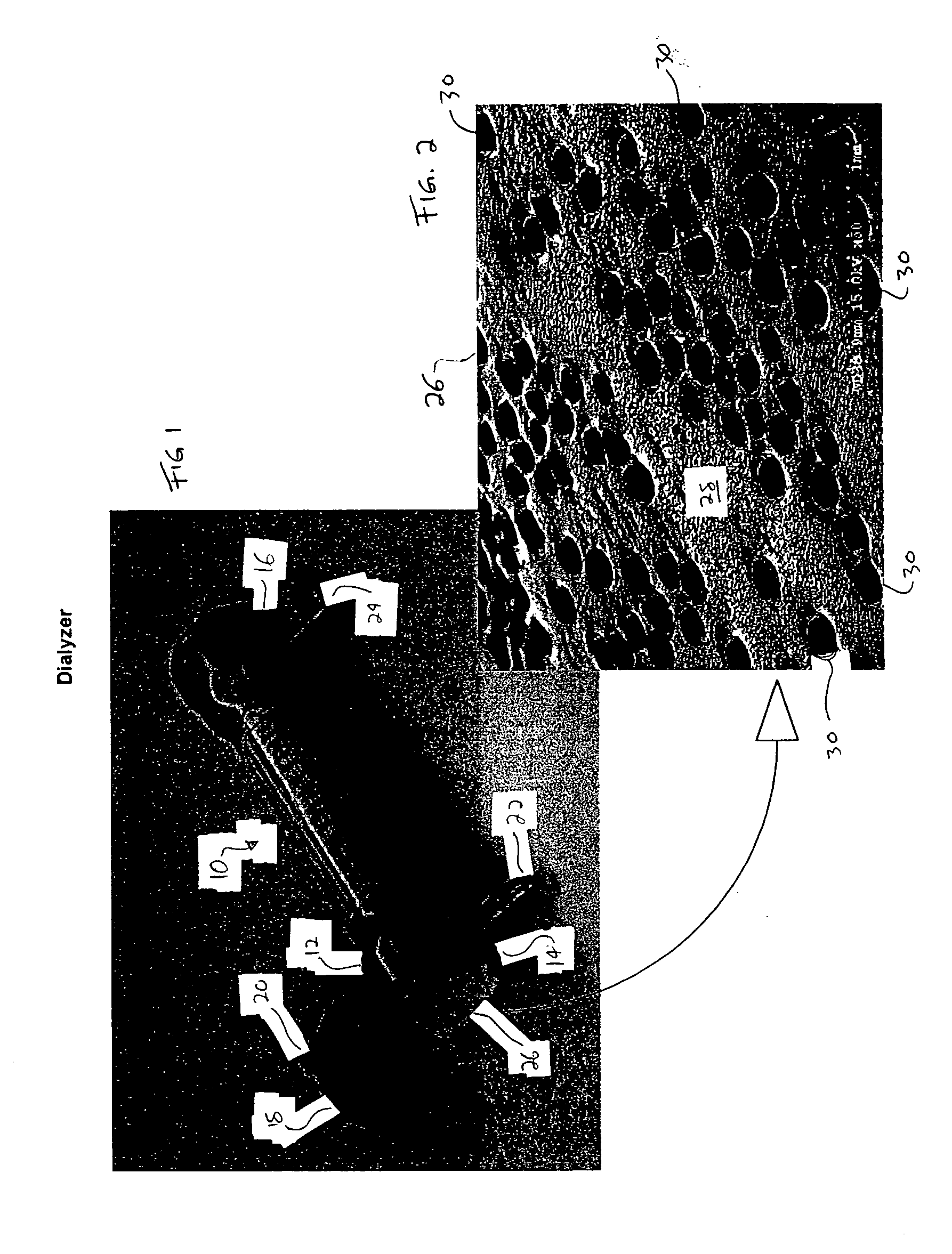 Dry aerosol leak detection for dialyzers