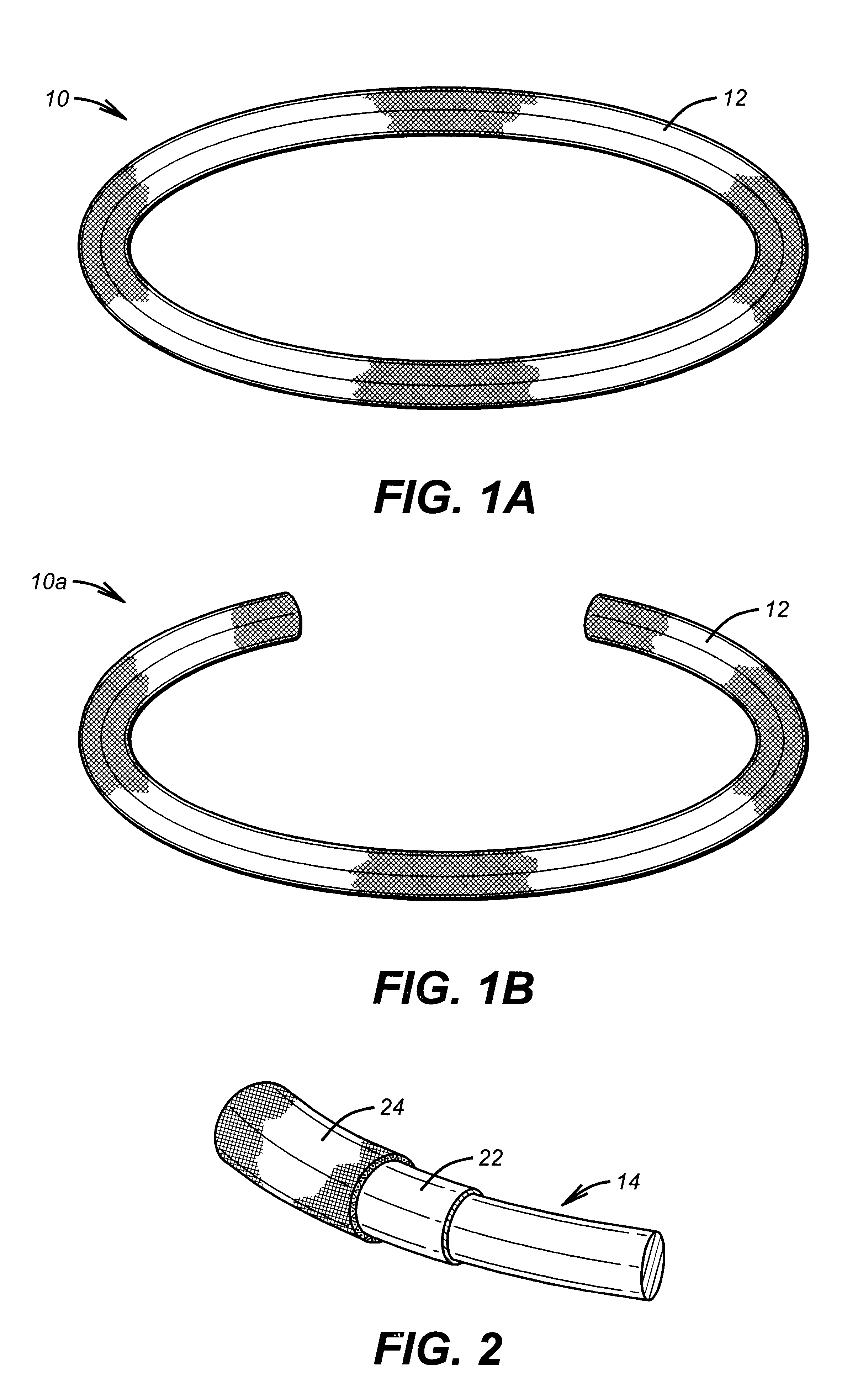 Antithrombogenic annuloplasty ring having a biodegradable insert