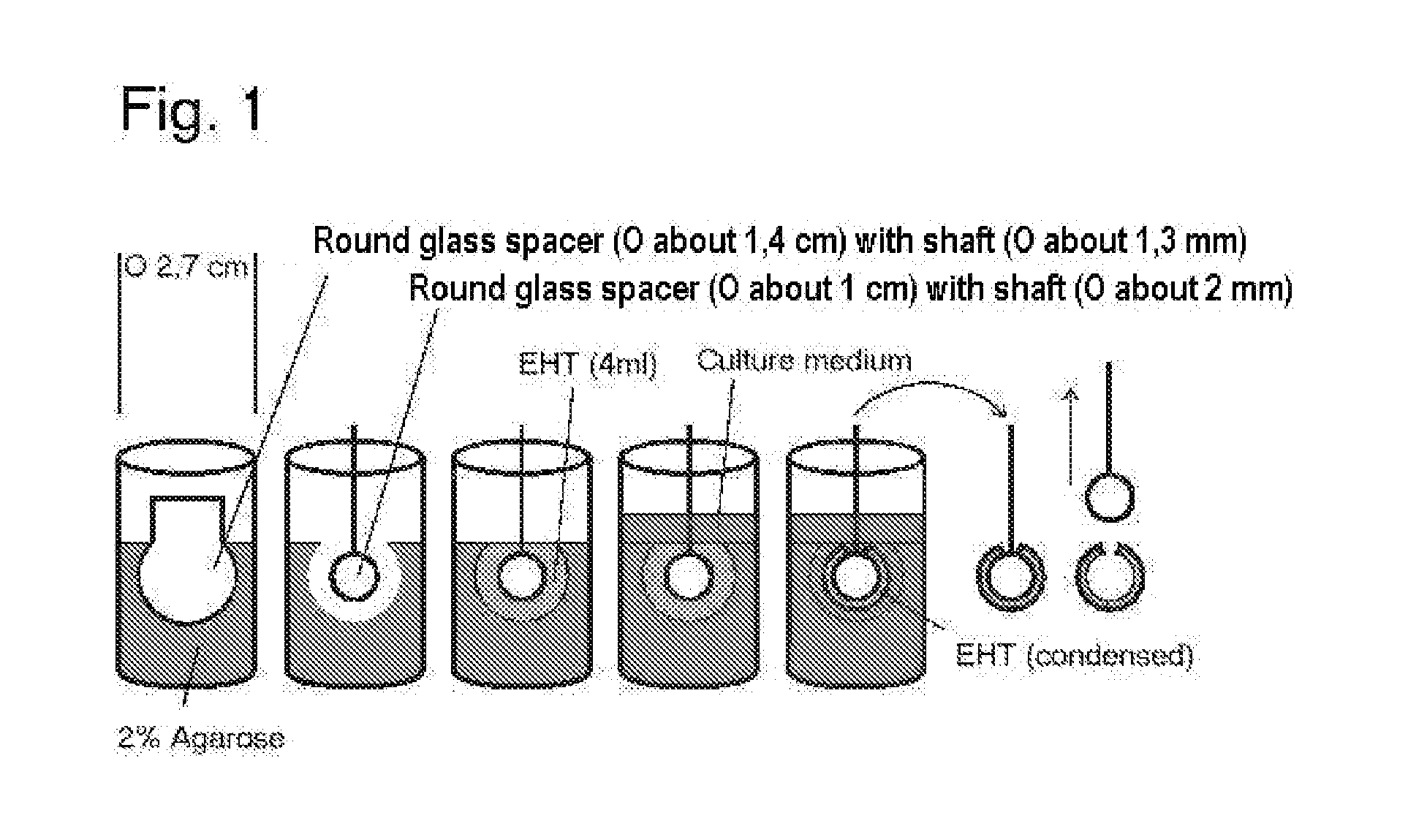 Pouch-Like Construct for Preventing Heart Distension