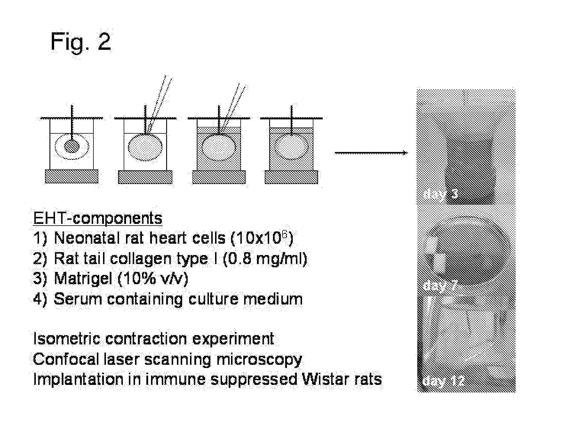 Pouch-Like Construct for Preventing Heart Distension