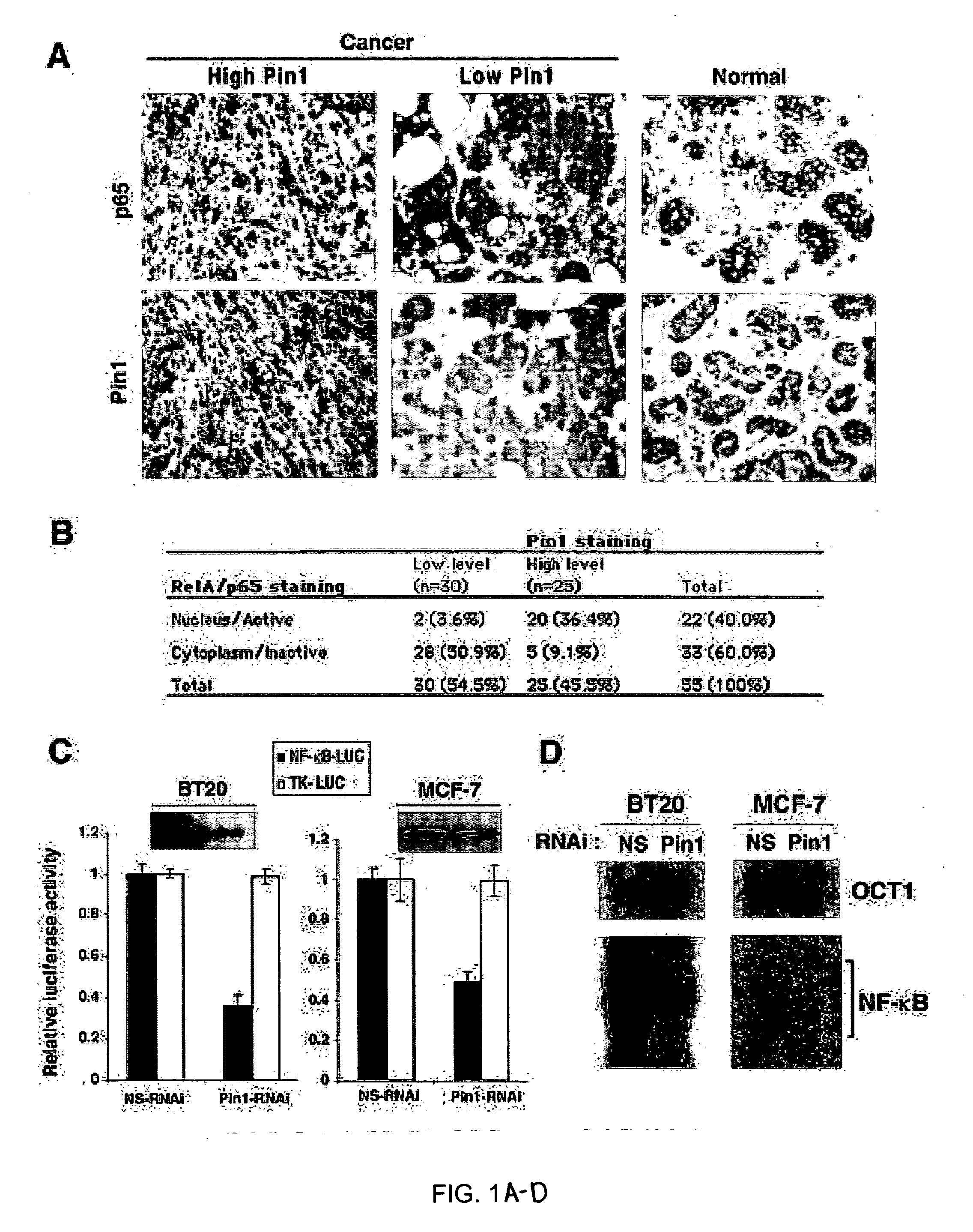 Novel regulatory mechanisms of NF-kappaB