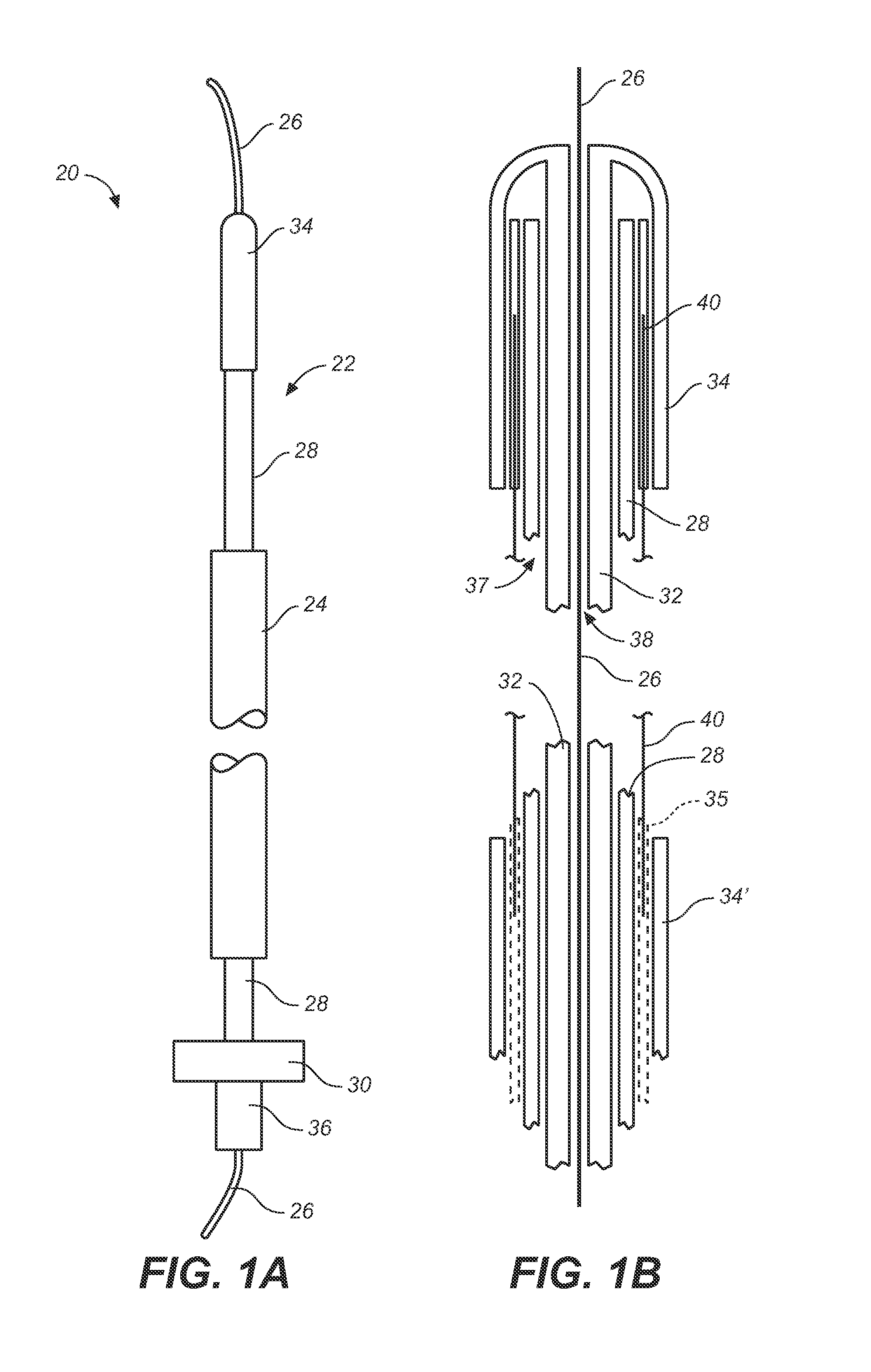 Branch Vessel Suture Stent System and Method