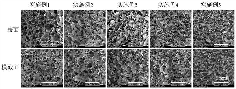 Preparation method and application of bionic multifunctional composite sponge dressing