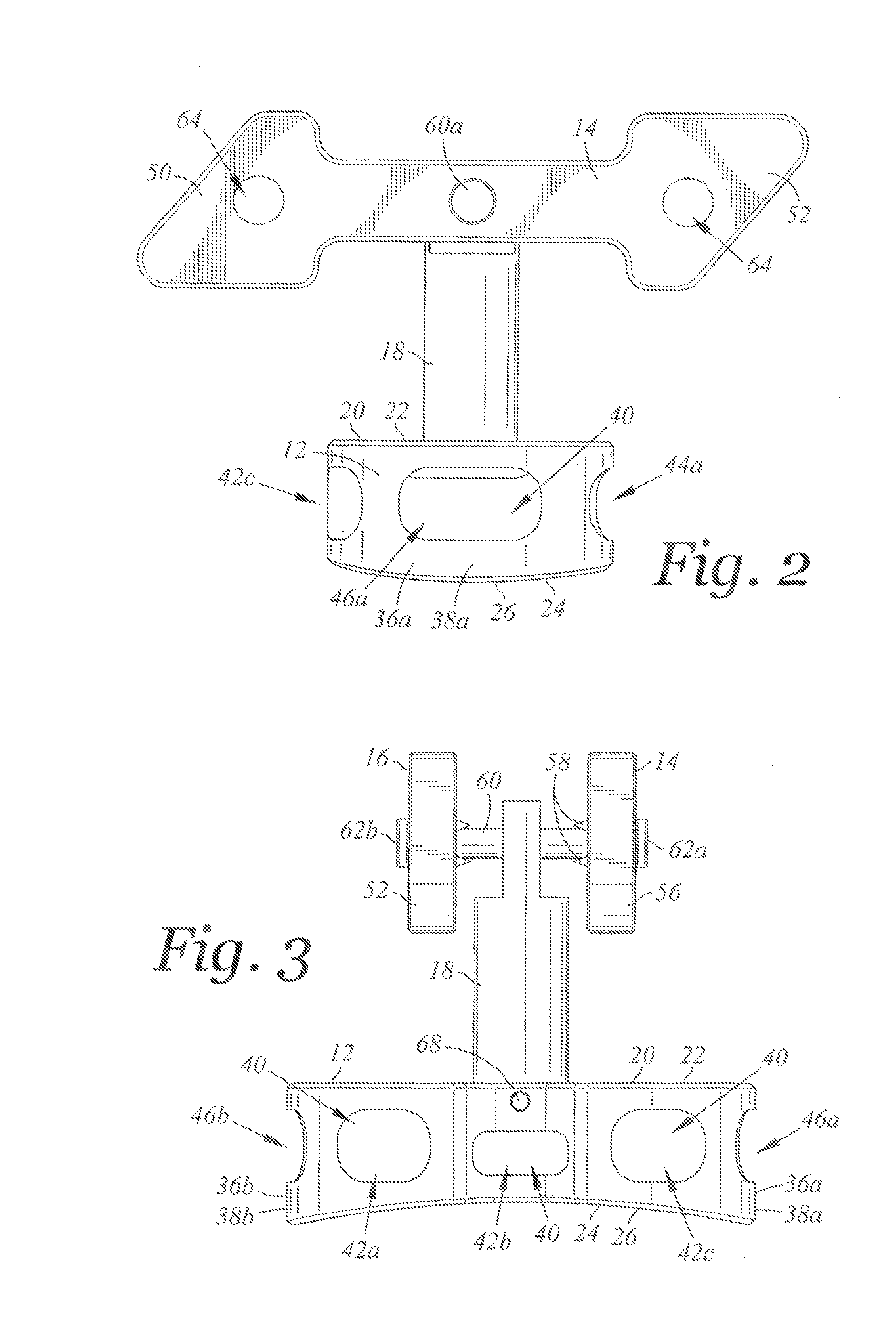 Spinal implant device with fusion cage and fixation plates and method of implanting