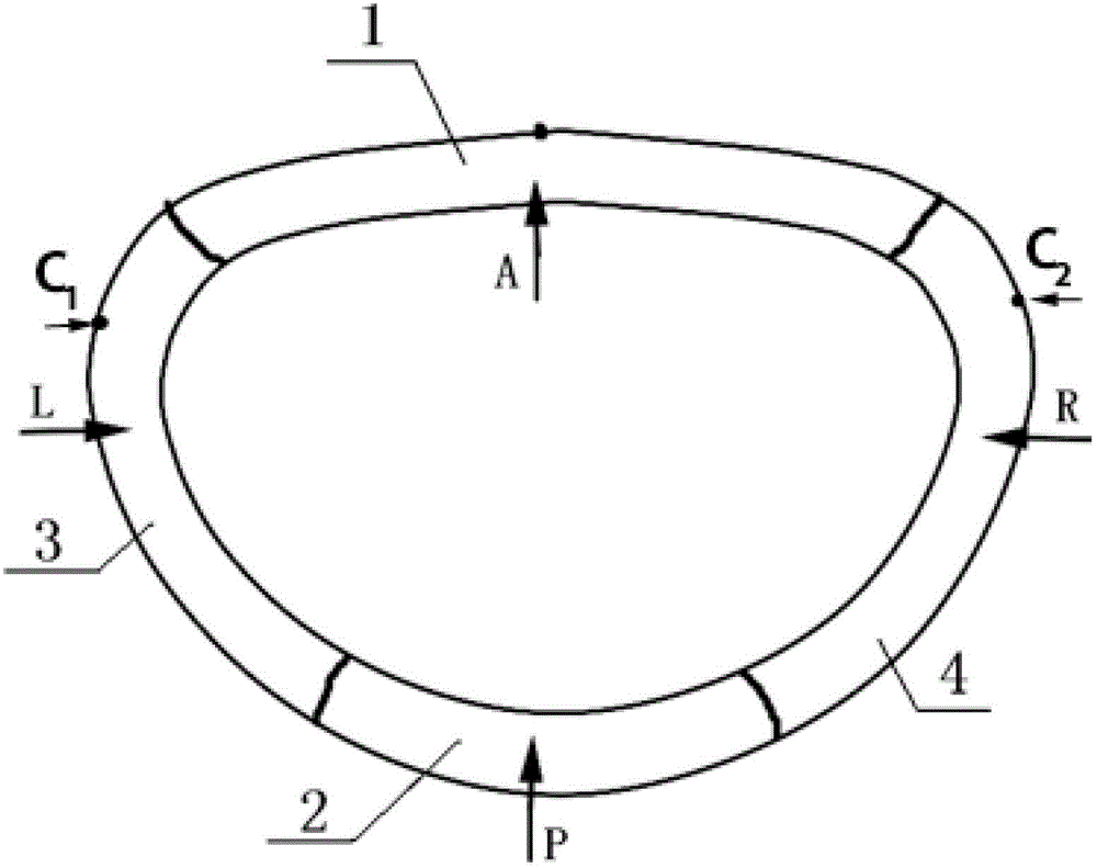 mitral annuloplasty ring