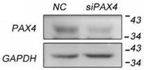 Application of pax4 gene expression inhibitor in the preparation of drugs for inhibiting fibrosis