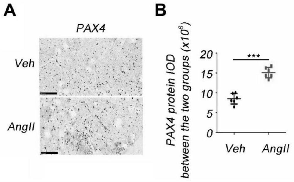 Application of pax4 gene expression inhibitor in the preparation of drugs for inhibiting fibrosis