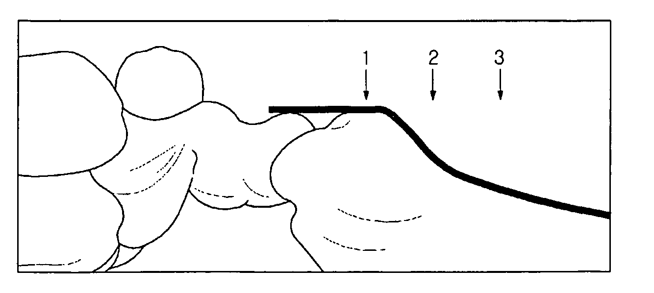 Blood pressure measurement apparatus