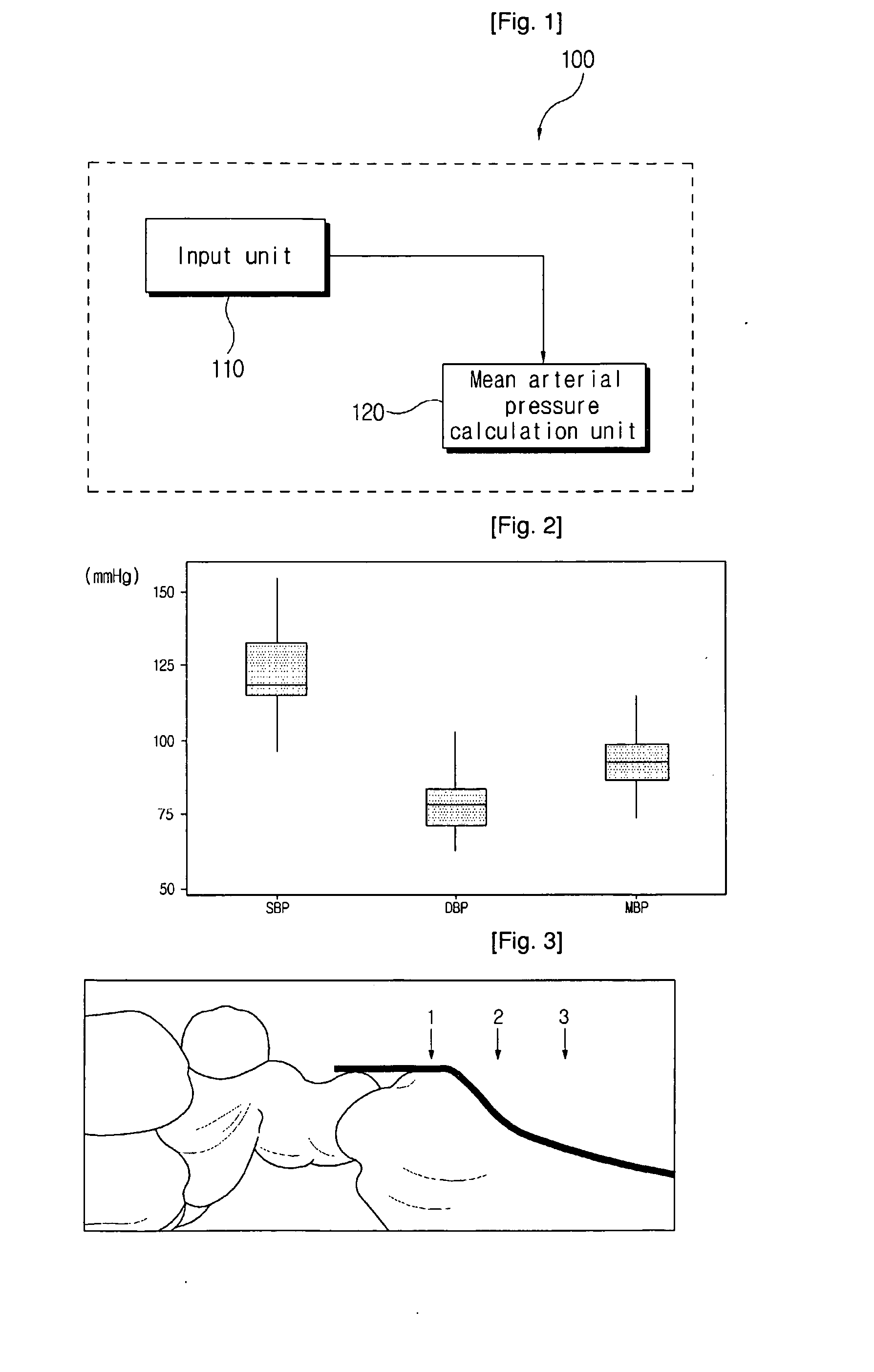 Blood pressure measurement apparatus