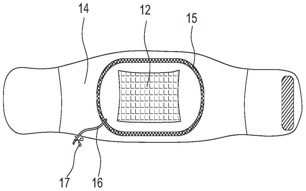 Palladium nanosheet/graphene-based traditional Chinese medicine hot compress device