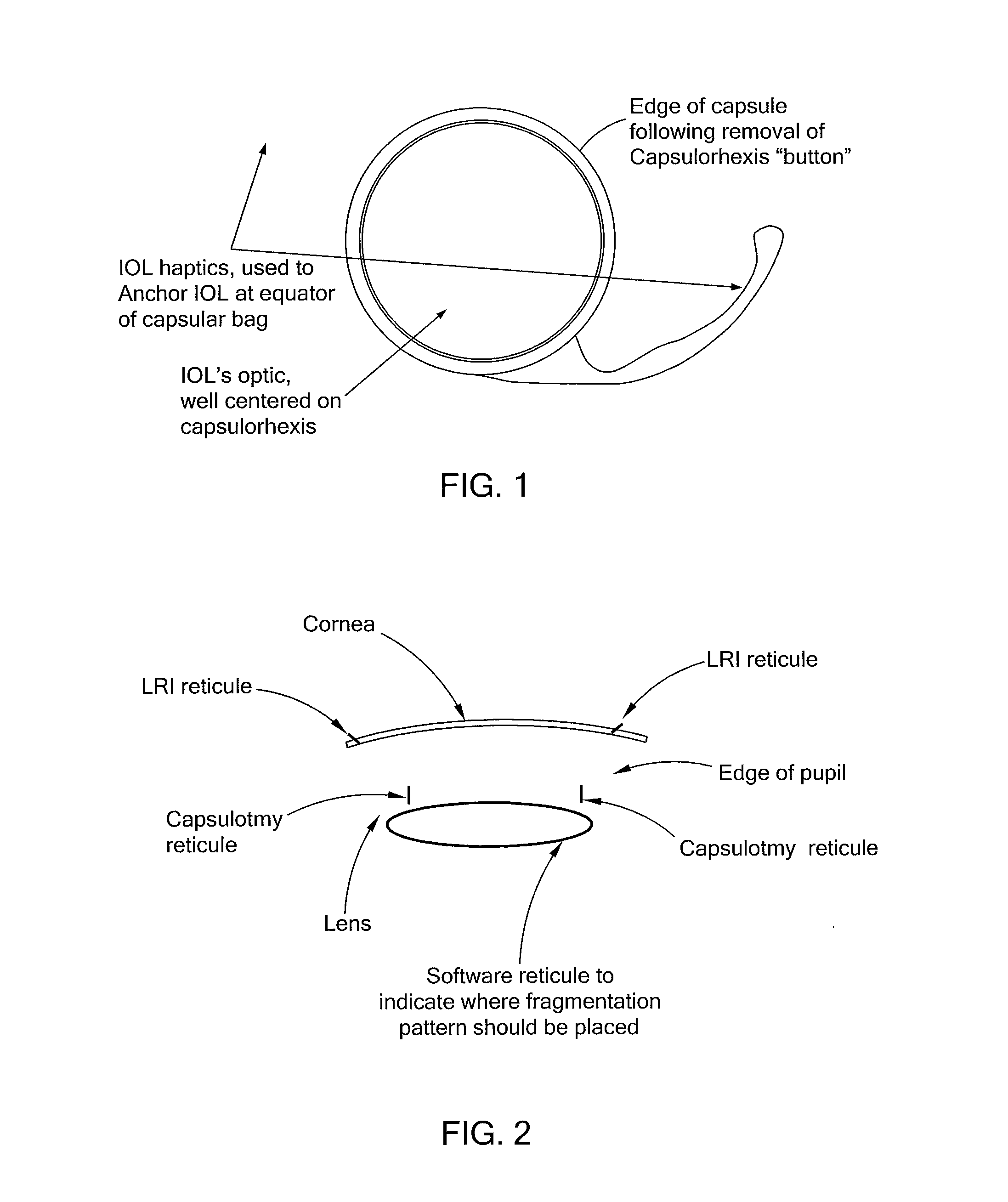 System and method for measuring tilt in the crystalline lens for laser phaco fragmentation