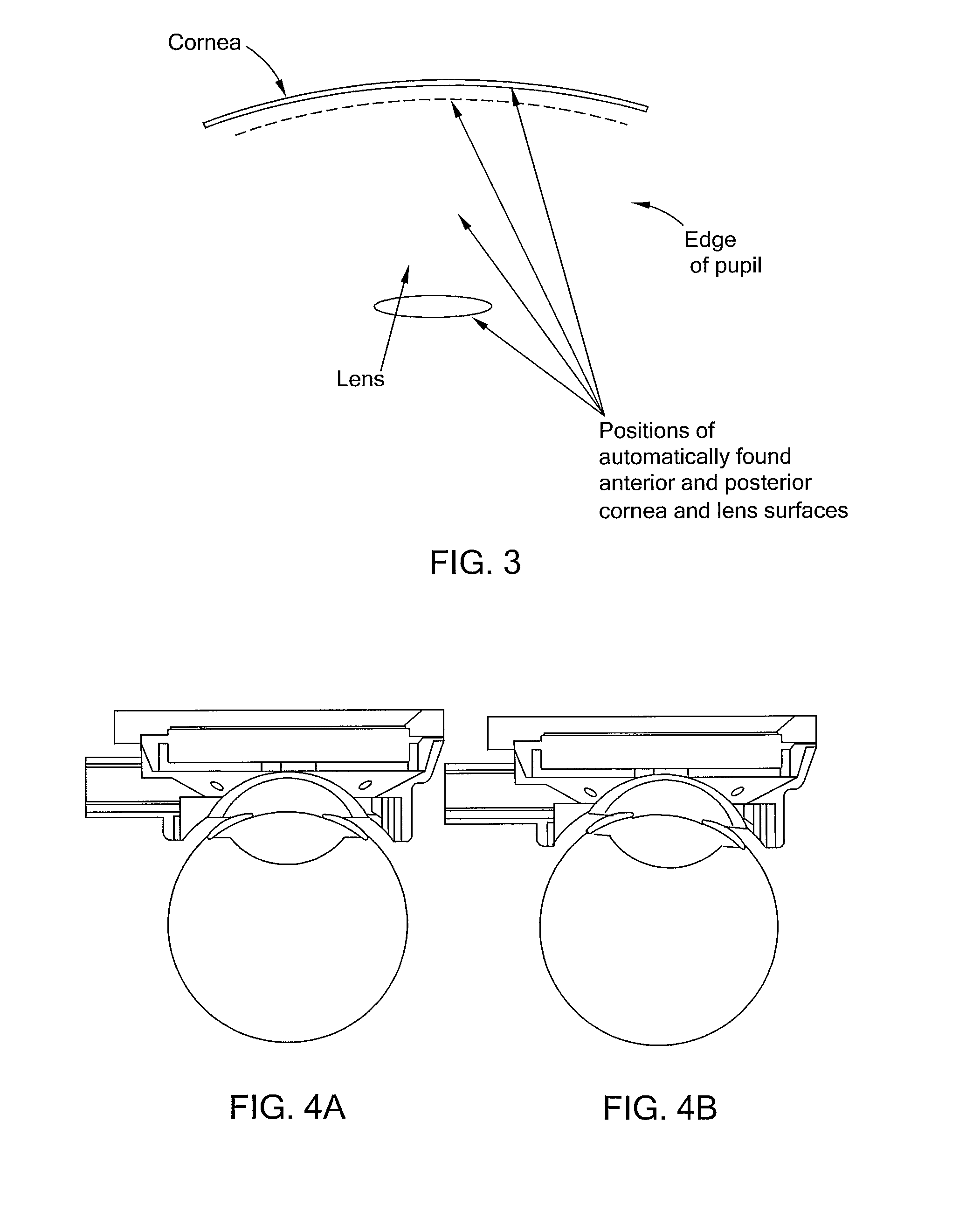 System and method for measuring tilt in the crystalline lens for laser phaco fragmentation