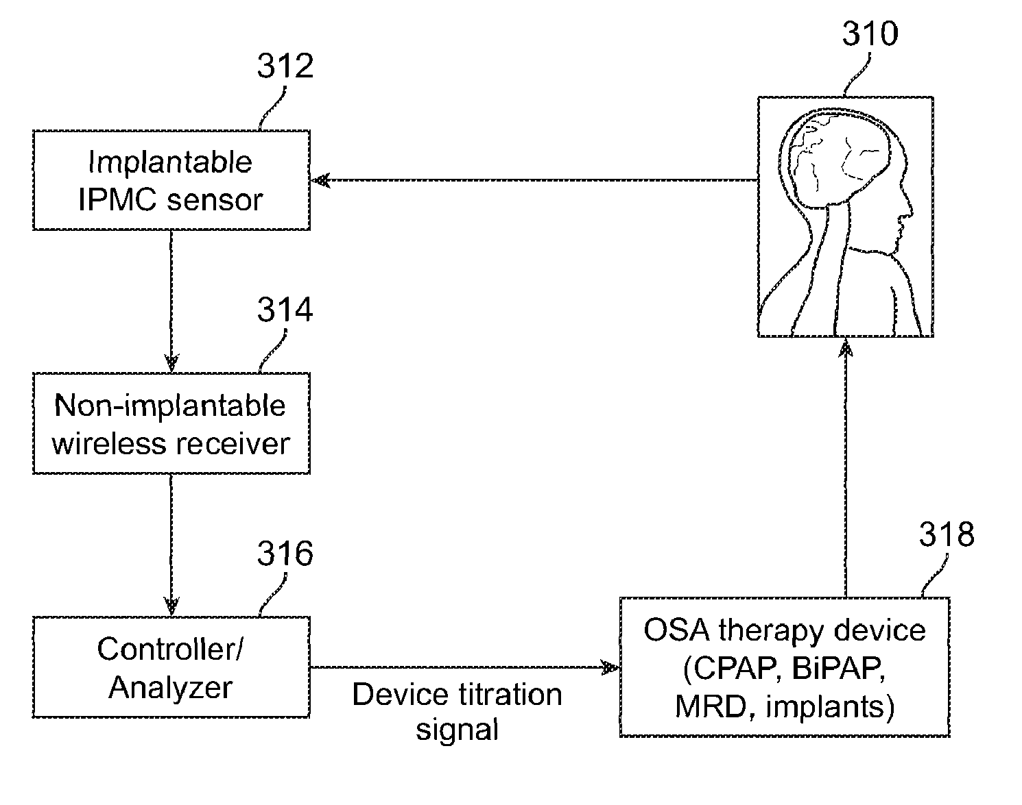 Auto-titration of positive airway pressure machine with feedback from implantable sensor